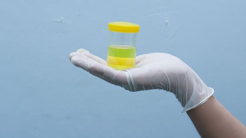 A gloved hand holding a sealed container with a yellow liquid, possibly urine, for testing.