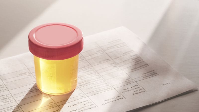 A urine sample in a sealed container placed over a lab test form in a clinical setting.