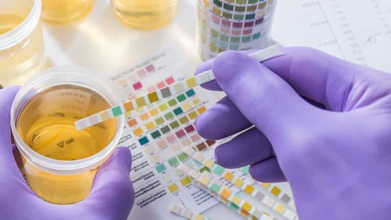 Percocet Addiction Program in New Jersey at Absolute Awakenings Center